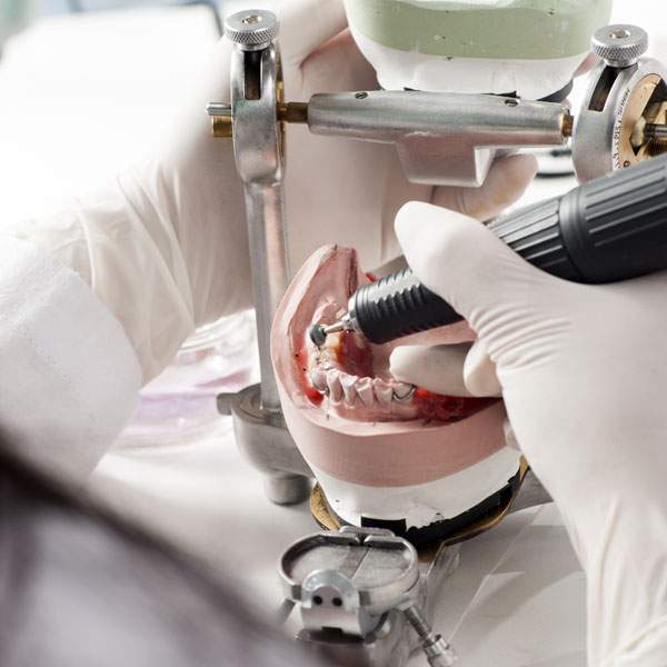 Dentier, Arvida